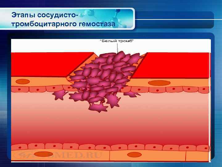 Этапы сосудистотромбоцитарного гемостаза 