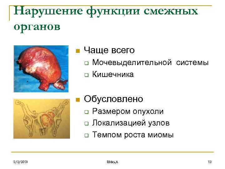 Нарушение функции смежных органов n Чаще всего q q n Обусловлено q q q