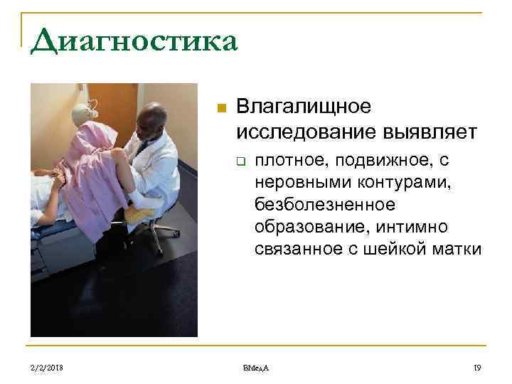 Диагностика n Влагалищное исследование выявляет q 2/2/2018 плотное, подвижное, с неровными контурами, безболезненное образование,