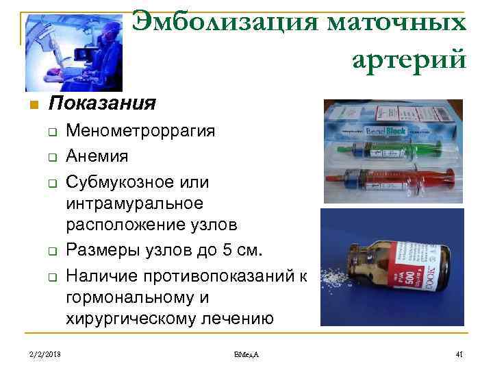 Эмболизация маточных артерий n Показания q q q 2/2/2018 Менометроррагия Анемия Субмукозное или интрамуральное