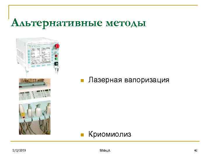 Альтернативные методы n n 2/2/2018 Лазерная вапоризация Криомиолиз ВМед. А 46 