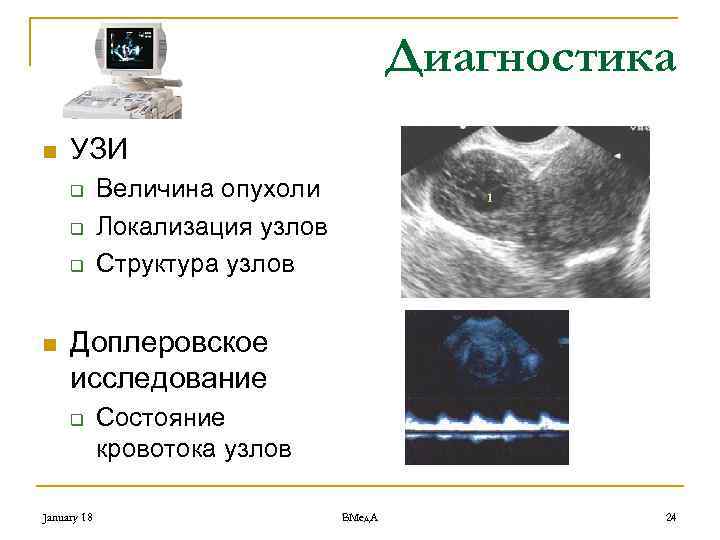 Диагностика n УЗИ q q q n Величина опухоли Локализация узлов Структура узлов Доплеровское