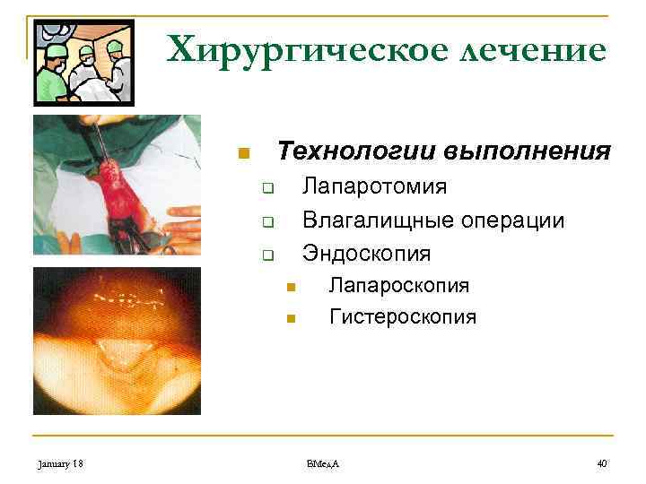 Хирургическое лечение Технологии выполнения n Лапаротомия Влагалищные операции Эндоскопия q q q n n
