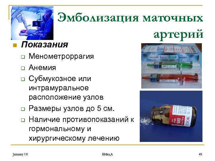 Эмболизация маточных артерий n Показания q q q January 18 Менометроррагия Анемия Субмукозное или