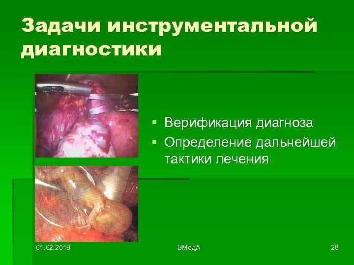 Задачи инструментальной диагностики § Верификация диагноза § Определение дальнейшей тактики лечения 01. 02. 2018