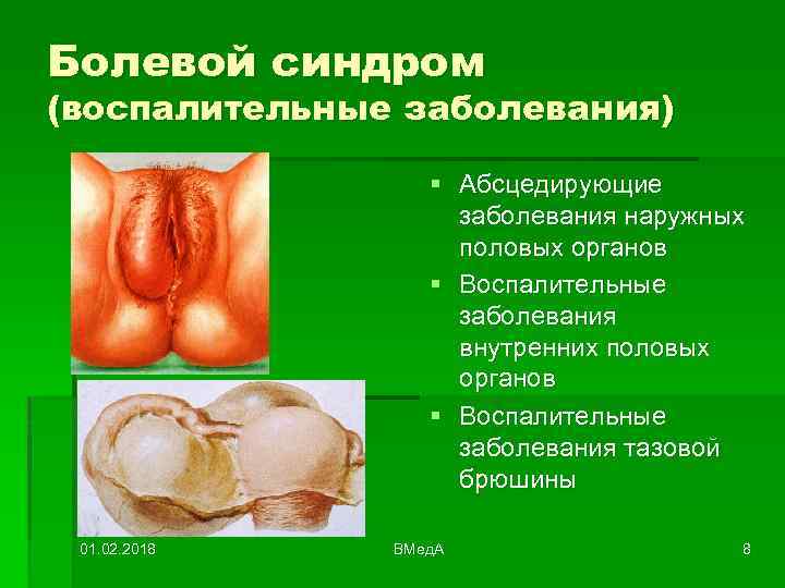 Болевой синдром (воспалительные заболевания) § Абсцедирующие заболевания наружных половых органов § Воспалительные заболевания внутренних