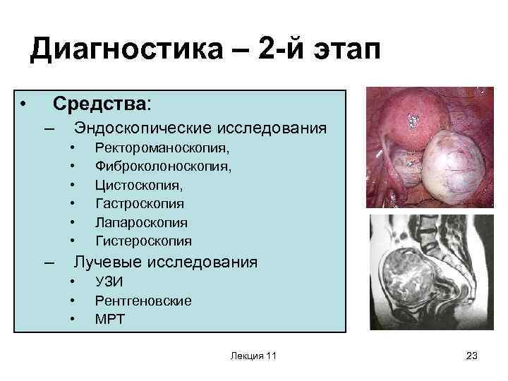 Диагностика – 2 -й этап • Средства: – Эндоскопические исследования • • • –