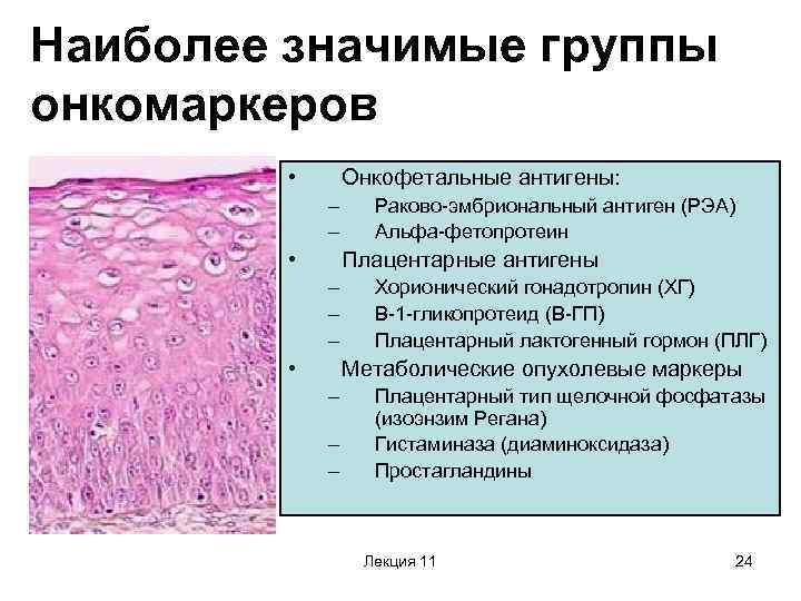 Наиболее значимые группы онкомаркеров • Онкофетальные антигены: – – • Раково-эмбриональный антиген (РЭА) Альфа-фетопротеин