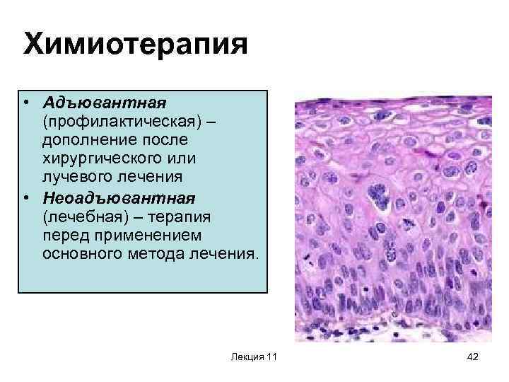 Химиотерапия • Адъювантная (профилактическая) – дополнение после хирургического или лучевого лечения • Неоадъювантная (лечебная)