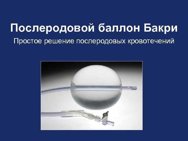 Послеродовой баллон Бакри Простое решение послеродовых кровотечений 
