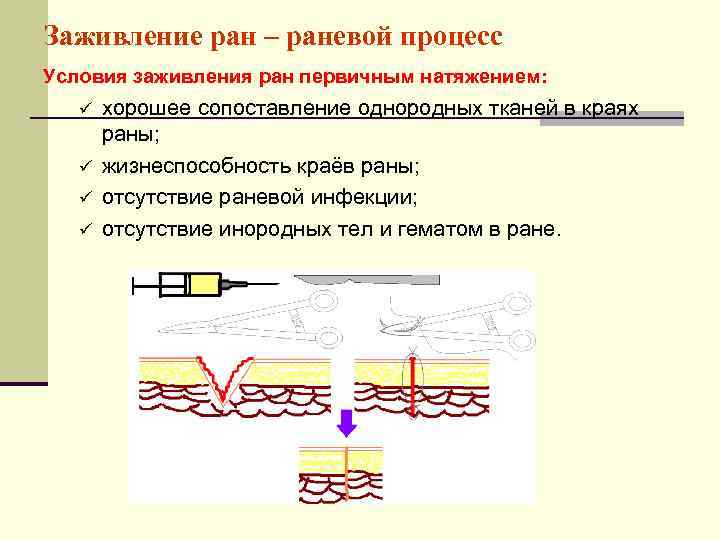 Заживление ран – раневой процесс Условия заживления ран первичным натяжением: ü хорошее сопоставление однородных