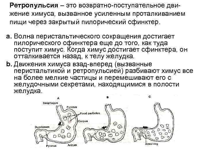 Ретропульсия – это возвратно-поступательное движение химуса, вызванное усиленным проталкиванием пищи через закрытый пилорический сфинктер.