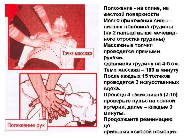 Положение - на спине, на жесткой поверхности Место приложения силы – нижняя половина грудины
