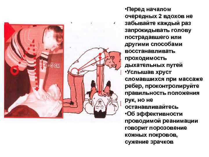  • Перед началом очередных 2 вдохов не забывайте каждый раз запрокидывать голову пострадавшего
