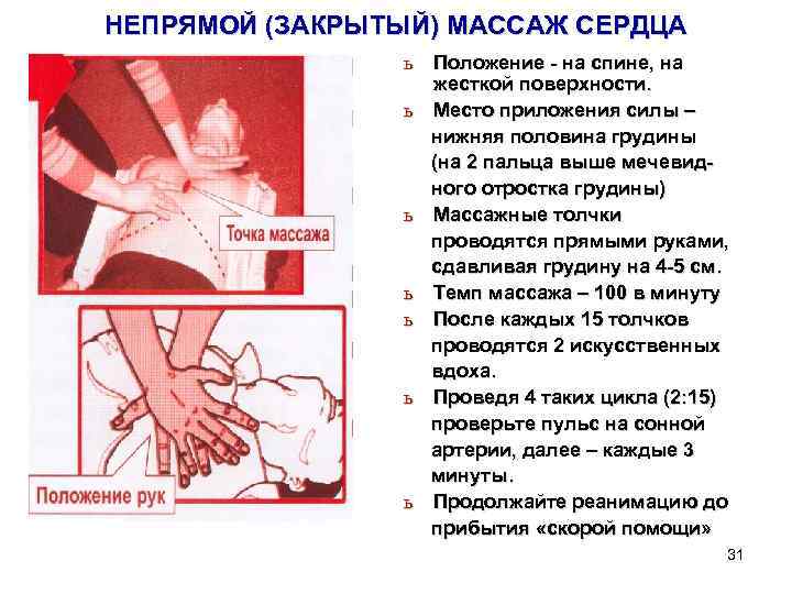 НЕПРЯМОЙ (ЗАКРЫТЫЙ) МАССАЖ СЕРДЦА ь Положение - на спине, на жесткой поверхности. ь Место