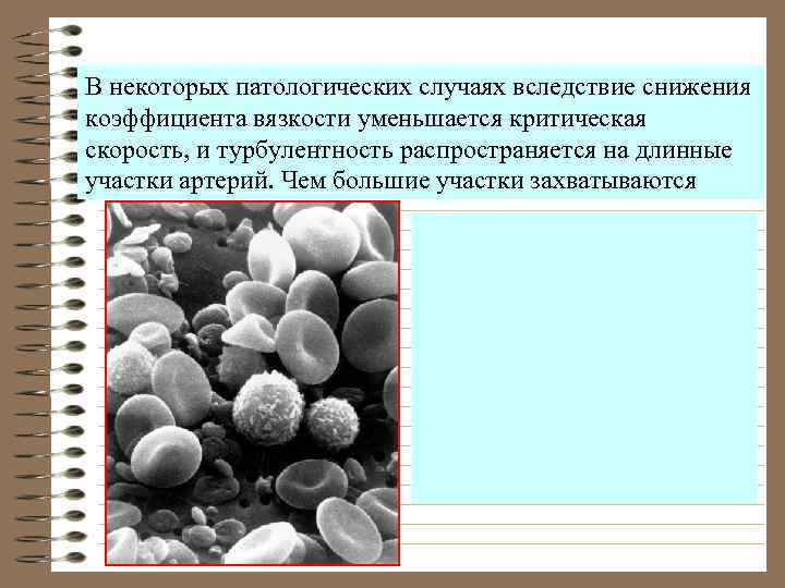 В некоторых патологических случаях вследствие снижения коэффициента вязкости уменьшается критическая скорость, и турбулентность распространяется