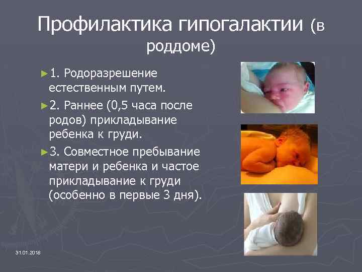 Профилактика гипогалактии роддоме) ► 1. Родоразрешение естественным путем. ► 2. Раннее (0, 5 часа