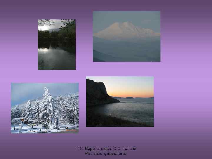 Н. С. Воротынцева. С. С. Гольев Рентгенопульмология 