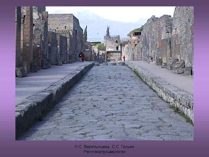 Н. С. Воротынцева. С. С. Гольев Рентгенопульмология 