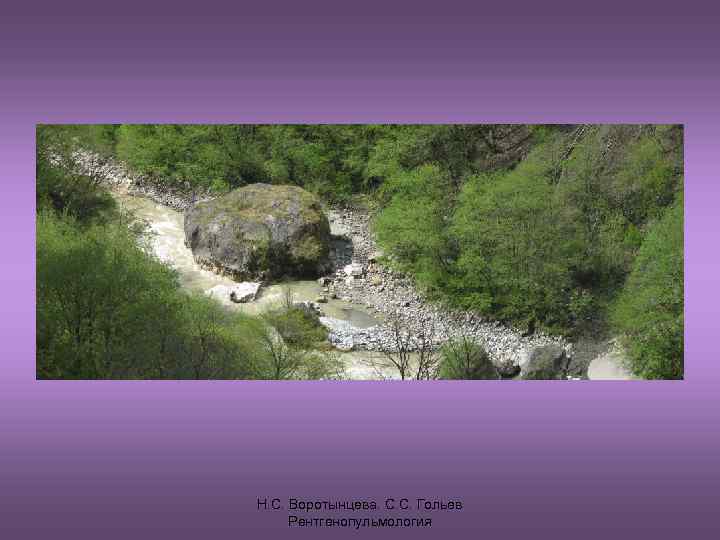 Н. С. Воротынцева. С. С. Гольев Рентгенопульмология 