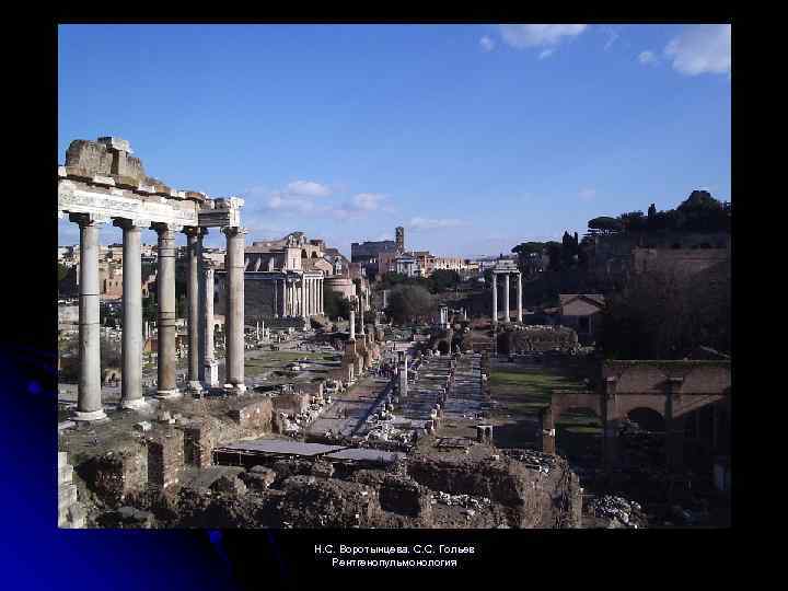 Н. С. Воротынцева. С. С. Гольев Рентгенопульмонология 