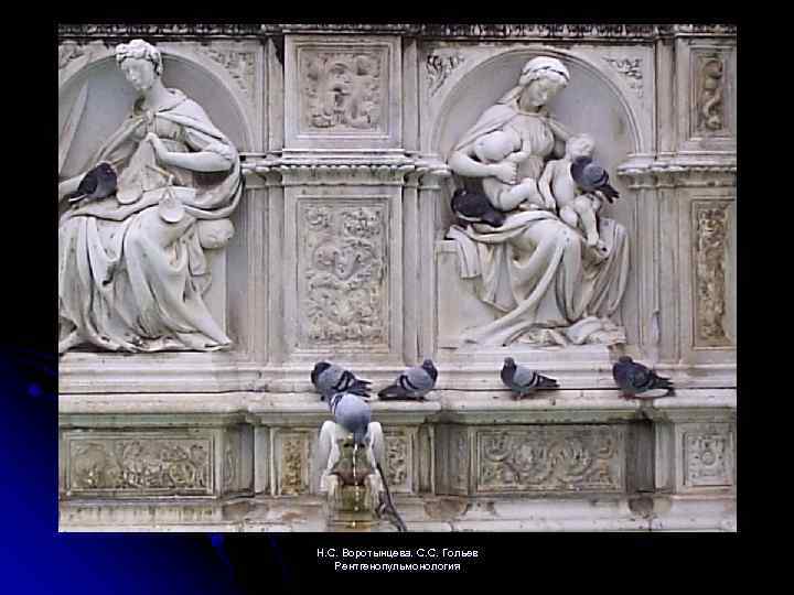 Н. С. Воротынцева. С. С. Гольев Рентгенопульмонология 