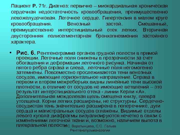 Пациент Р. 71 г. Диагноз: первично – миокардиальная хроническая сердечная недостаточность кровообращения, преимущественно левожелудочковая.