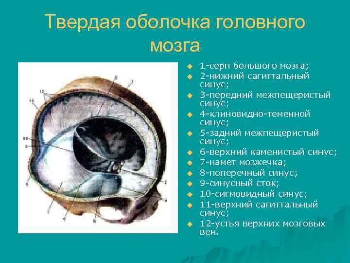 Твердая оболочка головного мозга u u u 1 -серп большого мозга; 2 -нижний сагиттальный