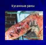 Кусанные раны 