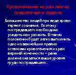 Кровотечение из ран плеча, предплечья и ладони Большинство людей при виде крови теряют сознание.
