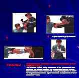 2 3 Что делать? 4 Зафиксировать руку косынкой Когда прибытие медицинского персонала ожидается в