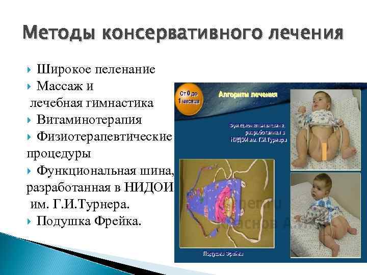 Методы консервативного лечения Широкое пеленание Массаж и лечебная гимнастика Витаминотерапия Физиотерапевтические процедуры Функциональная шина,