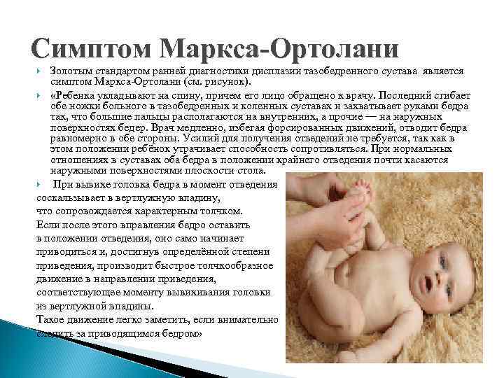 Симптом Маркса-Ортолани Золотым стандартом ранней диагностики дисплазии тазобедренного сустава является симптом Маркса-Ортолани (см. рисунок).