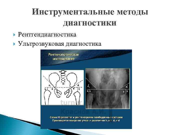 Инструментальные методы диагностики Рентгендиагностика Ультрозвуковая диагностика 