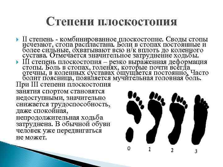 Степени плоскостопия II степень - комбинированное плоскостопие. Своды стопы исчезают, стопа распластана. Боли в