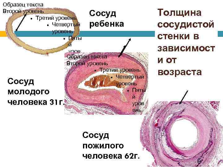 Образец текста Второй уровень Сосуд Третий уровень Четвертый ребенка уровень Пяты й уров Образец