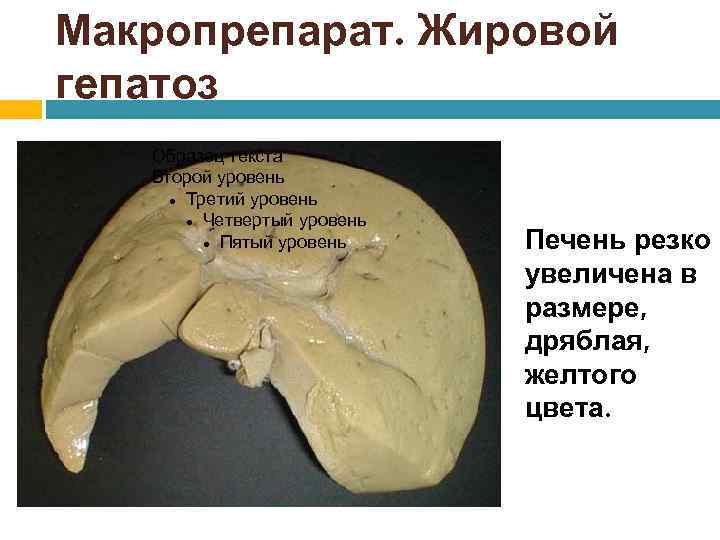 Макропрепарат. Жировой гепатоз Образец текста Второй уровень Третий уровень Четвертый уровень Пятый уровень Печень