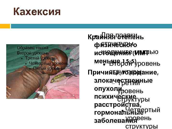 Кахексия Образец текста Второй уровень Третий уровень Четвертый уровень Пятый уровень Для Крайняяправки степень
