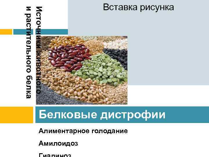 Источники животного и растительного белка Вставка рисунка Белковые дистрофии Алиментарное голодание Амилоидоз 