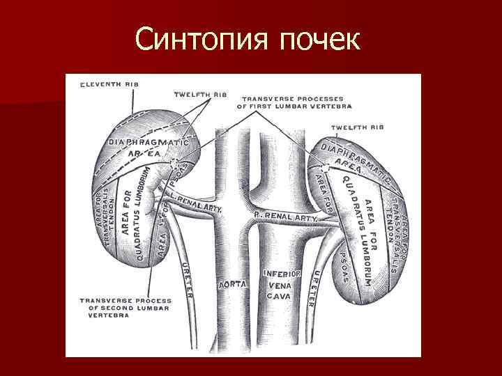 Синтопия почек 