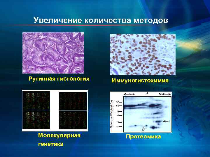 Увеличение количества методов Рутинная гистология Молекулярная генетика Иммуногистохимия Протеомика 