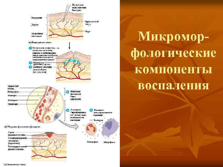 Микроморфологические компоненты воспаления 