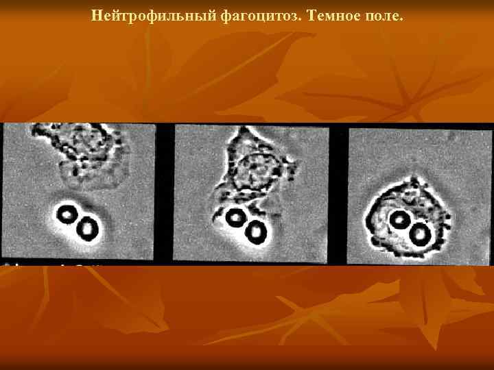 Нейтрофильный фагоцитоз. Темное поле. 