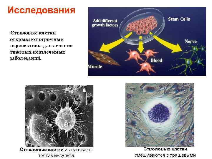 Исследования Стволовые клетки открывают огромные перспективы для лечения тяжелых неизлечимых заболеваний. Стволовые клетки испытывают