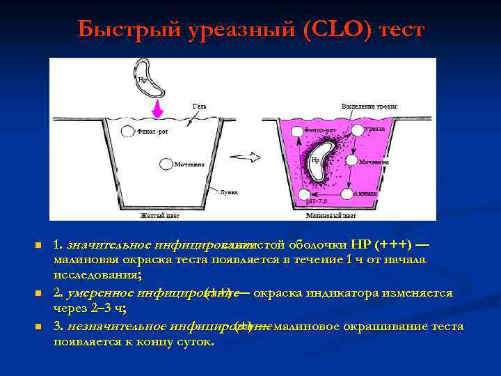 Быстрый уреазный (CLO) тест n n n 1. значительное инфицирование слизистой оболочки НР (+++)