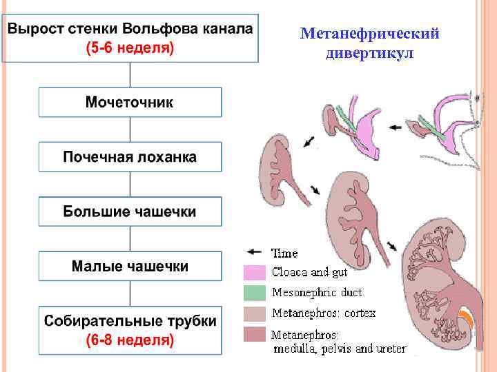Метанефрический дивертикул 
