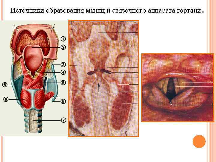 Источники образования мышц и связочного аппарата гортани. 
