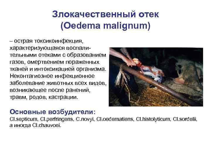 Злокачественный отек (Oedema malignum) – острая токсикоинфекция, характеризующаяся воспалительными отеками с образованием газов, омертвением