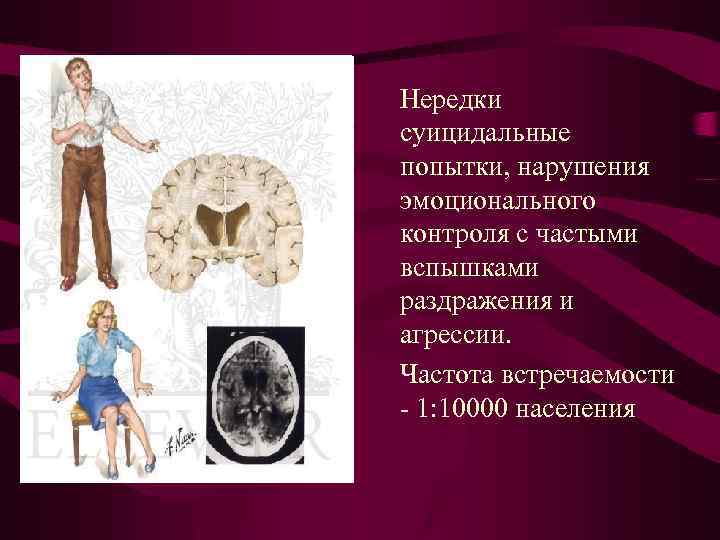 Нередки суицидальные попытки, нарушения эмоционального контроля с частыми вспышками раздражения и агрессии. Частота встречаемости