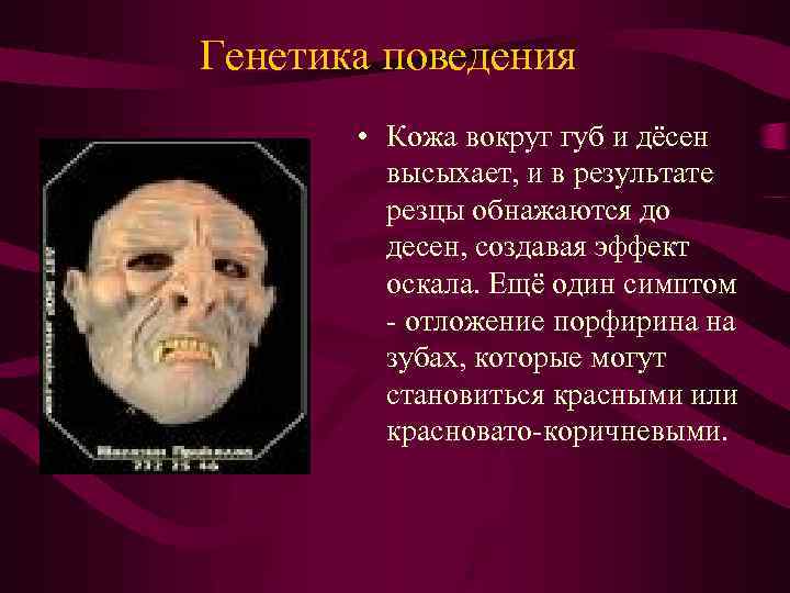 Генетика поведения • Кожа вокруг губ и дёсен высыхает, и в результате резцы обнажаются